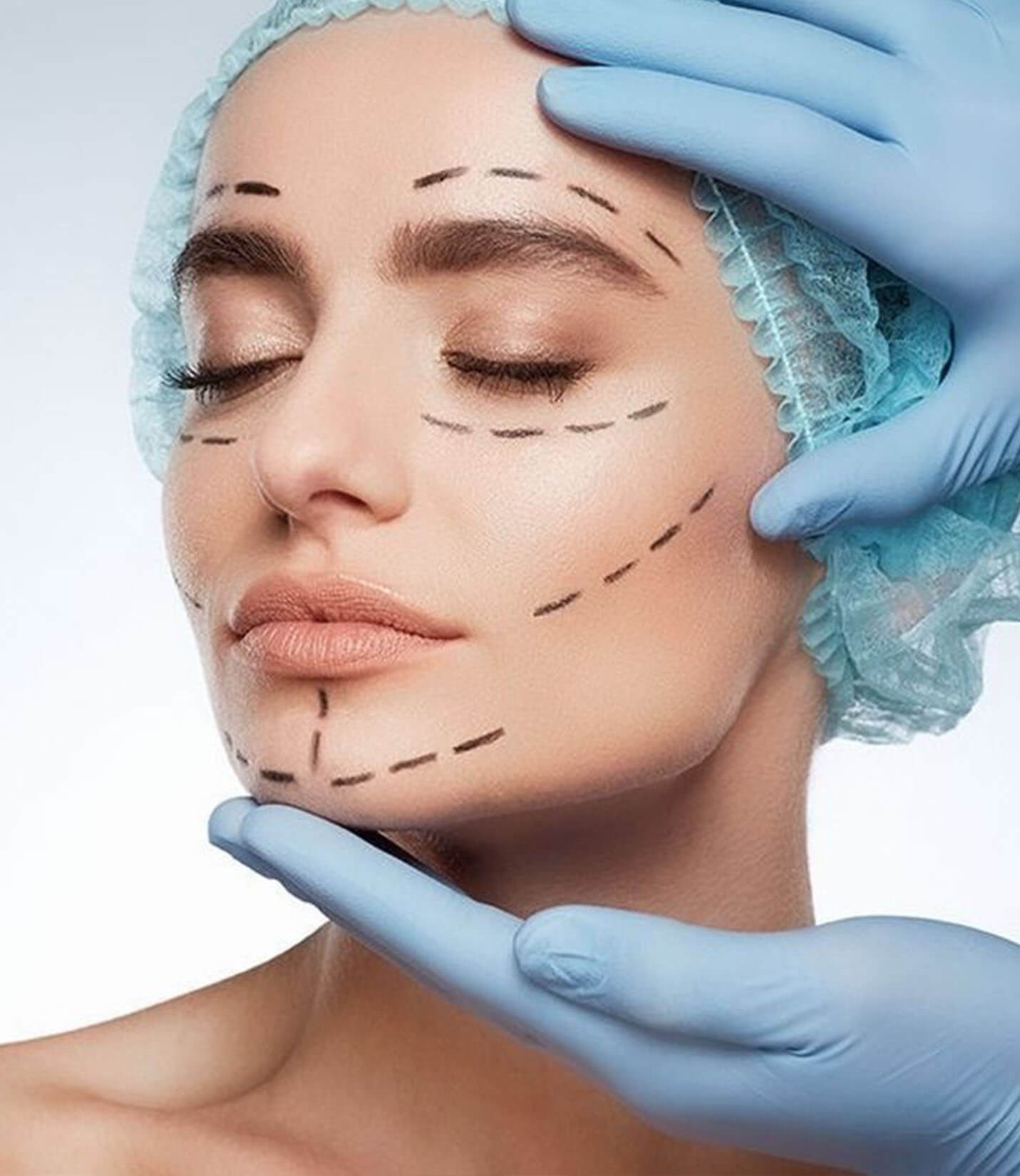 Rejuvenecimiento Facial